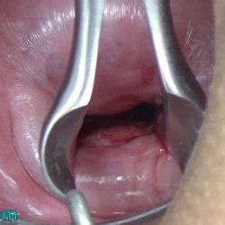 Japanese mom insemination cum in cervix abused forced impregnation pregnant